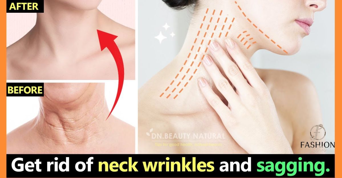 How To Reduce Neck lines With These Simple Tricks