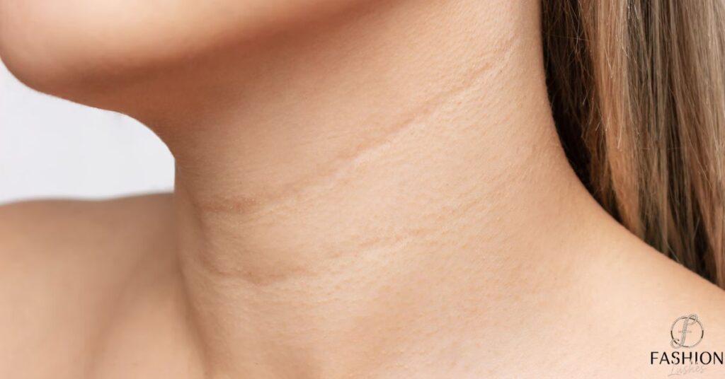 How to Stop Neck Wrinkles